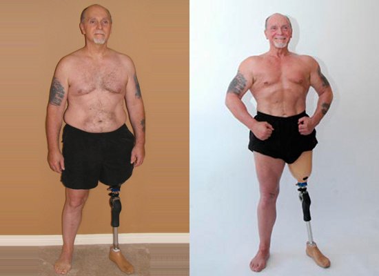 Errol Hannigan Before and After