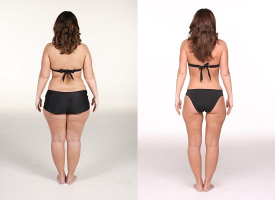 Melissa Durling Amazing Transformation