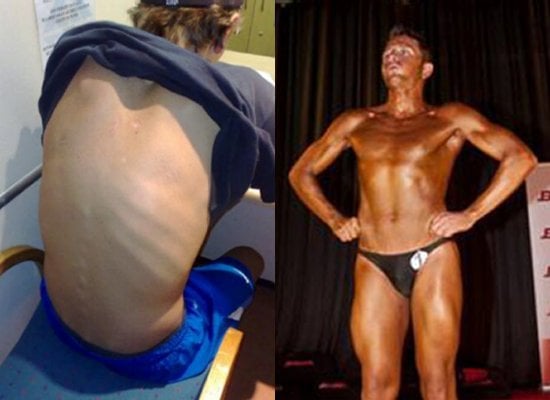 Michael Mitchell before and after.